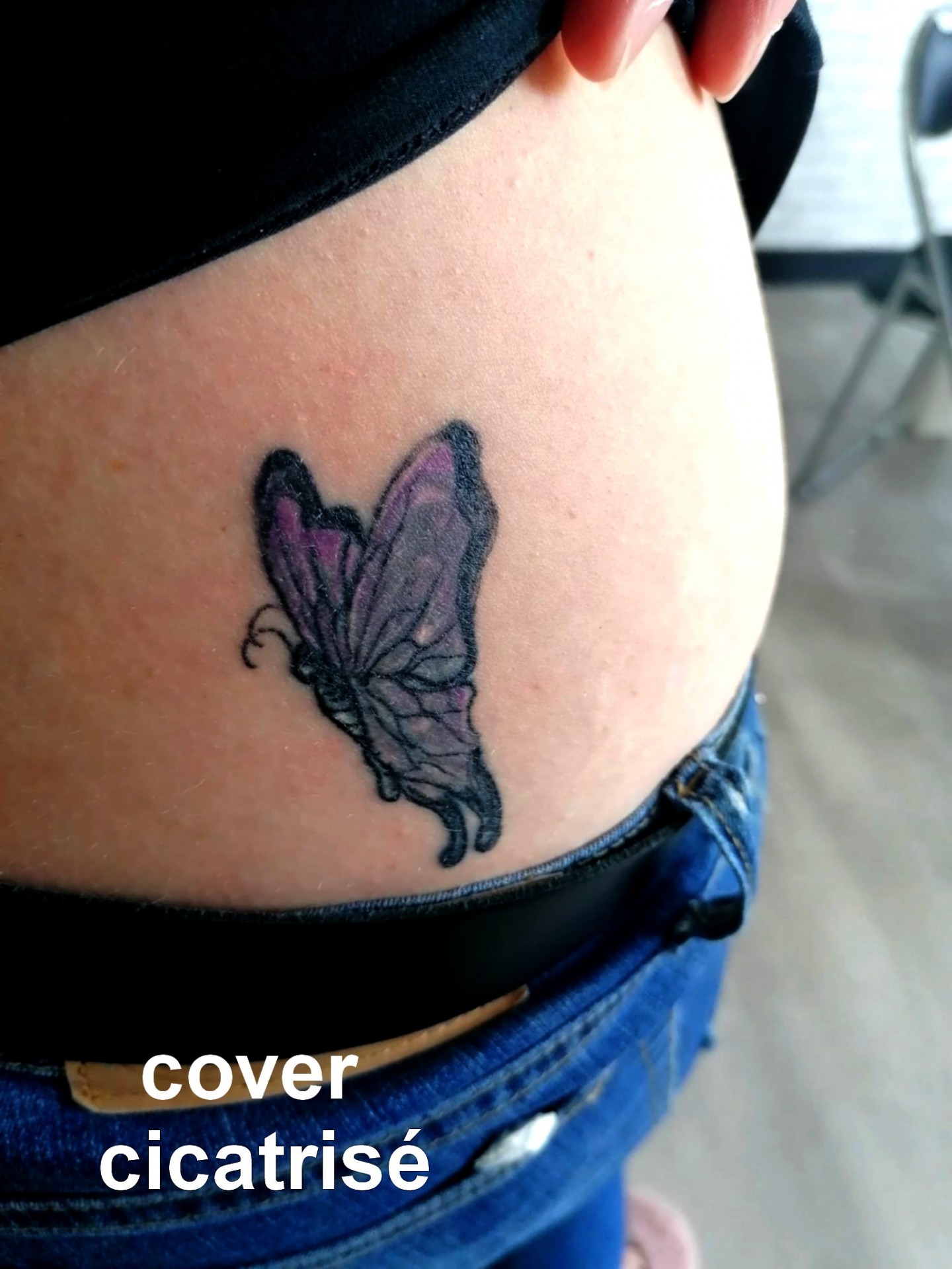cover papillon cicatrisé